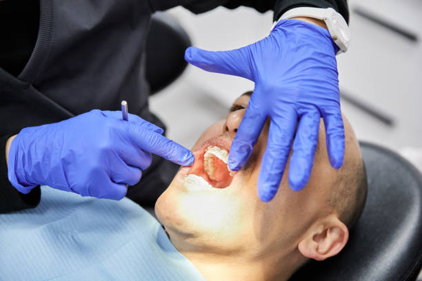 Best Broken or Chipped Tooth Repair in Lyford, TX